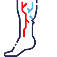 Imagem Membros inferiores